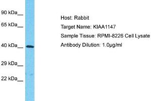 Host: Rabbit Target Name: KIAA1147 Sample Tissue: Human RPMI-8226 Whole Cell Antibody Dilution: 1ug/ml (DENND11/KIAA1147 antibody  (C-Term))