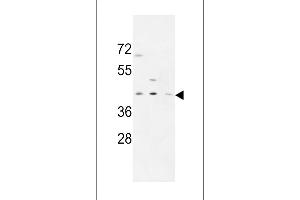 PRPF38A antibody  (C-Term)