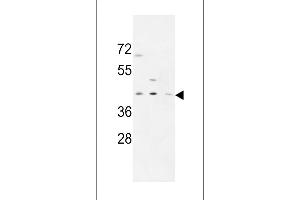 PR38A Antibody (C-term) (ABIN653884 and ABIN2843131) western blot analysis in MDA-M,CEM,HL-60 cell line lysates (35 μg/lane).