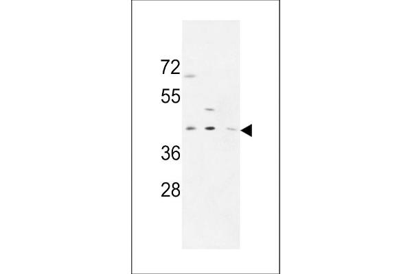 PRPF38A antibody  (C-Term)