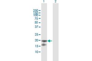 Western Blot analysis of IL1RN expression in transfected 293T cell line by IL1RN MaxPab polyclonal antibody. (IL1RN antibody  (AA 1-177))