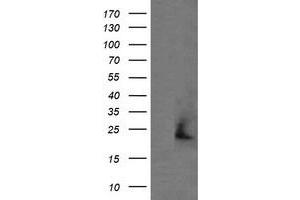 Image no. 1 for anti-Amyloid P Component, Serum (APCS) antibody (ABIN1500900) (APCS antibody)