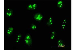 Immunofluorescence of purified MaxPab antibody to C14orf169 on HeLa cell. (C14orf169 + NO66 antibody  (AA 1-641))