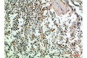 Immunohistochemical analysis of paraffin-embedded Human-spleen, antibody was diluted at 1:100 (CD247 antibody  (AA 51-100))