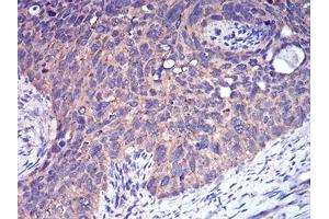 Immunohistochemistry (IHC) image for anti-Complement Factor H-Related 5 (CFHR5) (AA 344-569) antibody (ABIN5923027)