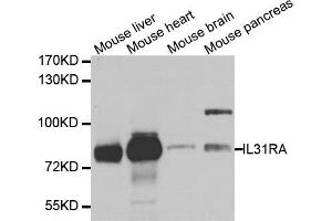 Western blot analysis of extracts of various cell lines, using IL31RA antibody. (IL31RA antibody)