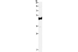 Western Blotting (WB) image for anti-Interleukin 11 Receptor, alpha (IL11RA) antibody (ABIN2421099)
