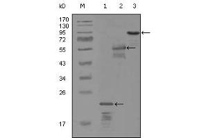 Western blot analysis using ERBB3 mouse mAb against truncated Trx-ERBB3 recombinant protein (1), MBP-ERBB3 (aa1175-1275) recombinant protein (2) and truncated ERBB3(aa665-1342)-hIgGFc transfected CH0-K1 cell lysate (3). (ERBB3 antibody)