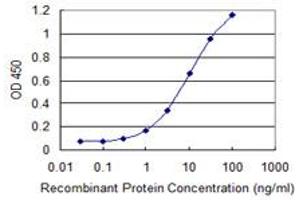 Detection limit for recombinant GST tagged UGT1A6 is 0. (UGT1A6 antibody  (AA 44-143))