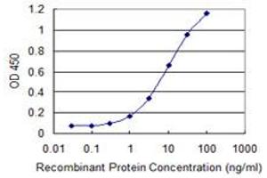 Detection limit for recombinant GST tagged UGT1A6 is 0. (UGT1A6 antibody  (AA 44-143))