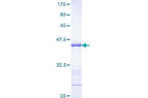 Image no. 1 for Fibroblast Growth Factor Receptor 1 (FGFR1) (AA 31-150) protein (GST tag) (ABIN1354029)