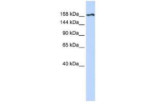 Western Blot showing KDR antibody used at a concentration of 1-2 ug/ml to detect its target protein.
