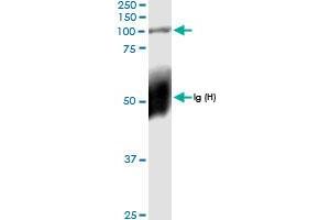 Immunoprecipitation of PLOD2 transfected lysate using anti-PLOD2 MaxPab rabbit polyclonal antibody and Protein A Magnetic Bead , and immunoblotted with PLOD2 MaxPab rabbit polyclonal antibody (D01) . (PLOD2 antibody  (AA 1-758))