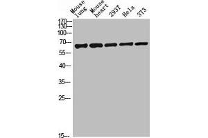 Western blot analysis of mouse-lung mouse-lung lysate, antibody was diluted at 2000. (C-Type Lectin Domain Family 4, Member M (CLEC4M) (AA 271-320) antibody)