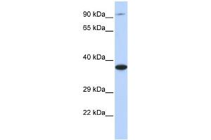 WB Suggested Anti-BBS5 Antibody Titration: 0. (BBS5 antibody  (Middle Region))
