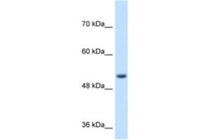 Western Blotting (WB) image for anti-Signal Peptide Peptidase-Like 2B (SPPL2B) antibody (ABIN2464000) (SPPL2B antibody)