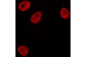 ABIN6276831 staining  Hela cells by IF/ICC. (CTBP1 antibody  (Internal Region))