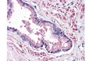 Anti-STEAP2 antibody IHC of human prostate. (STEAP2 antibody  (C-Term))