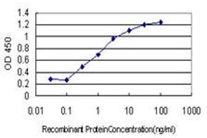 Detection limit for recombinant GST tagged FOXA1 is approximately 0. (FOXA1 antibody  (AA 367-472))