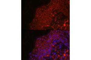 Immunofluorescence analysis of human skin using EGF Rabbit pAb (ABIN6133981, ABIN6139971, ABIN6139973 and ABIN6217680) at dilution of 1:100 (40x lens). (EGF antibody  (AA 850-950))