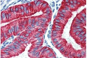 Uterus, Human: Formalin-Fixed, Paraffin-Embedded (FFPE) (Cytokeratin 19 antibody  (C-Term))