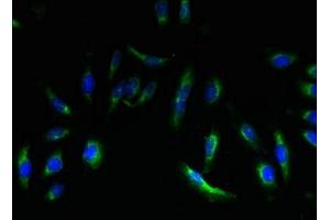 Immunofluorescent analysis of Hela cells using ABIN7151933 at dilution of 1:100 and Alexa Fluor 488-congugated AffiniPure Goat Anti-Rabbit IgG(H+L) (EMP3 antibody  (AA 25-65))