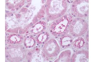 Human Kidney: Formalin-Fixed, Paraffin-Embedded (FFPE) (Serotonin Receptor 4 antibody  (Cytoplasmic Domain))