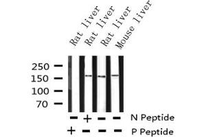 Western blot analysis of Phospho-EGFR (Tyr1016) expression in various lysates