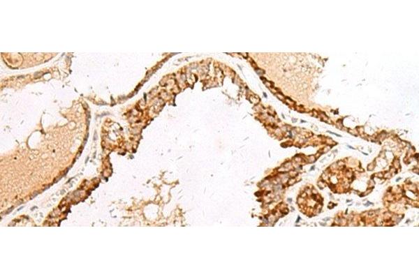 GRP antibody