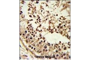 Formalin-fixed and paraffin-embedded human testis tissue reacted with TBP Antibody (Center), which was peroxidase-conjugated to the secondary antibody, followed by DAB staining. (TBP antibody  (AA 210-239))