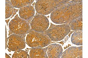 ABIN7093239 and ABIN7097252 at 1/100 staining Mouse testis tissue by IHC-P. (MLKL antibody  (pSer360))