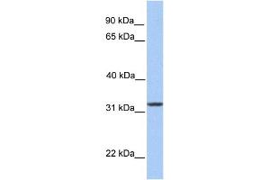 WB Suggested Anti-SIGLEC12 Antibody Titration:  0. (SIGLEC12 antibody  (N-Term))