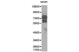 Western Blotting (WB) image for anti-Vitronectin (VTN) antibody (ABIN1875340)