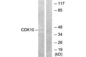 Western blot analysis of extracts from 293 cells, using CDK10 Antibody. (CDK10 antibody  (AA 51-100))