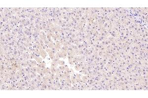 Immunohistochemistry (IHC) image for anti-Serpin Peptidase Inhibitor, Clade G (C1 Inhibitor), Member 1 (SERPING1) (AA 399-500) antibody (ABIN7426820)