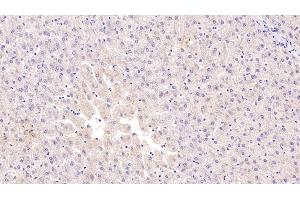 Detection of C1INH in Human Liver Tissue using Monoclonal Antibody to Complement 1 Inhibitor (C1INH) (SERPING1 antibody  (AA 399-500))
