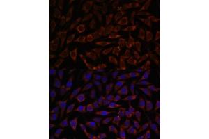 Immunofluorescence analysis of L929 cells using BZW2 antibody (ABIN7265831) at dilution of 1:100. (BZW2 antibody  (AA 190-300))