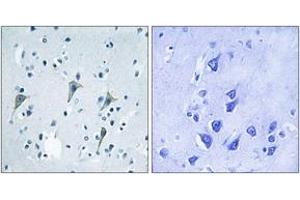 Immunohistochemistry analysis of paraffin-embedded human brain tissue, using GPR85 Antibody.