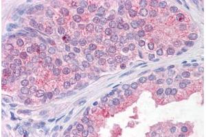 Anti-TM9SF1 antibody  ABIN1049413 IHC staining of human, prostate. (TM9SF1 antibody  (Internal Region))