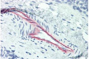 Human Thymus, Vessel (formalin-fixed, paraffin-embedded) stained with HSPG2 antibody ABIN337194 at 5 ug/ml followed by biotinylated anti-mouse IgG secondary antibody ABIN481714, alkaline phosphatase-streptavidin and chromogen. (HSPG2 antibody)