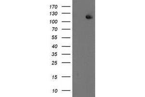 HEK293T cells were transfected with the pCMV6-ENTRY control (Left lane) or pCMV6-ENTRY ERCC4 (Right lane) cDNA for 48 hrs and lysed. (ERCC4 antibody)