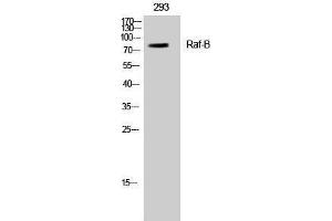 Western Blotting (WB) image for anti-B-Raf proto-oncogene, serine/threonine kinase (BRAF) (Ser188) antibody (ABIN3180845) (BRAF antibody  (Ser188))