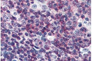 Human Tonsil (formalin-fixed, paraffin-embedded) stained with CEBPB antibody ABIN364320 at 10 ug/ml followed by biotinylated anti-mouse IgG secondary antibody ABIN481714, alkaline phosphatase-streptavidin and chromogen. (CEBPB antibody)