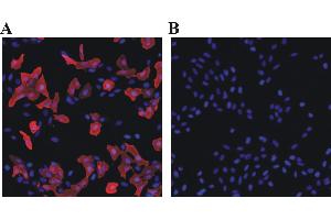 Immunofluorescent analysis for testing of Rabbit anti-chicken polyclonal antibody DyLight 549 conjugate as secondary antibody. (Rabbit anti-Chicken IgY Antibody (DyLight 549))