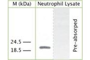 WB on human neutrophil lysate using Rabbit antibody to internal part of human Cathelicidin antimicrobial peptide (CAP-18): IgG (ABIN350180) at 50 µg/ml concentration. (Cathelicidin antibody  (AA 40-80))