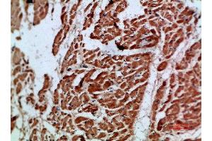 Immunohistochemical analysis of paraffin-embedded human-heart, antibody was diluted at 1:200 (ARTN antibody  (AA 101-150))