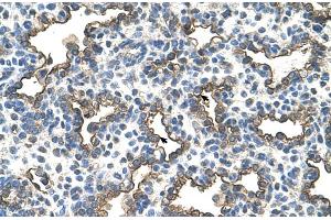 Human Lung (Podoplanin antibody  (N-Term))