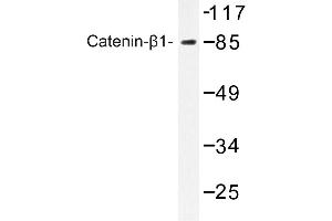 Image no. 1 for anti-Catenin (Cadherin-Associated Protein), beta 1, 88kDa (CTNNB1) antibody (ABIN272182) (CTNNB1 antibody)