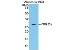Western Blotting (WB) image for anti-Acrosin (ACR) (AA 43-291) antibody (ABIN1857876) (Acrosin antibody  (AA 43-291))