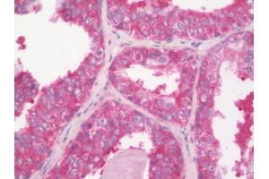 Immunohistochemistry (IHC) image for anti-Solute Carrier Family 16, Member 13 (Monocarboxylic Acid Transporter 13) (SLC16A13) (AA 398-426) antibody (ABIN1935534)